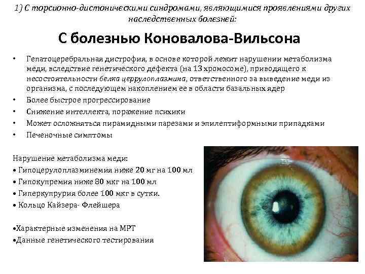 1) С торсионно-дистоническими синдромами, являющимися проявлениями других     наследственных болезней: 