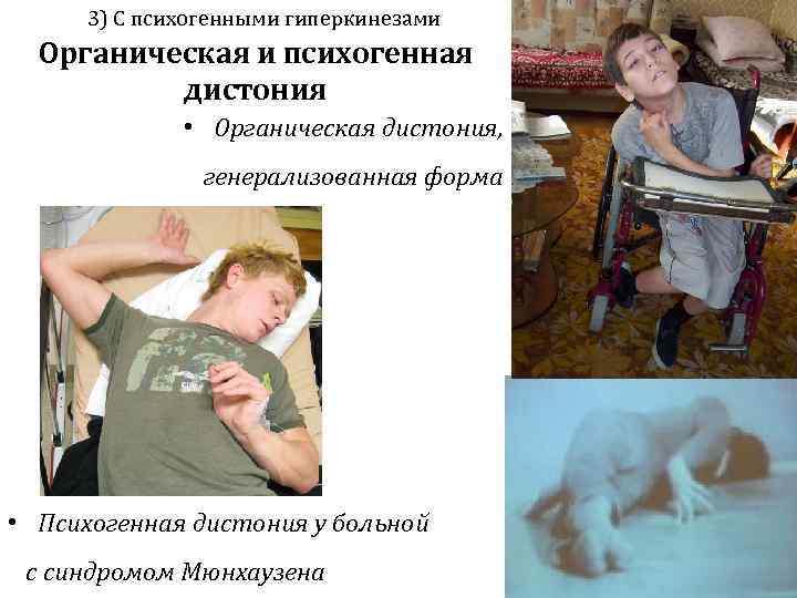  3) С психогенными гиперкинезами  Органическая и психогенная  дистония   