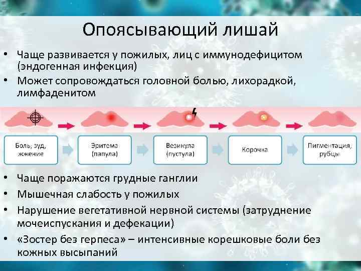 Опоясывающий лишай • Чаще развивается у пожилых, лиц с иммунодефицитом Опоясывающий лишай • Чаще развивается у пожилых, лиц с иммунодефицитом