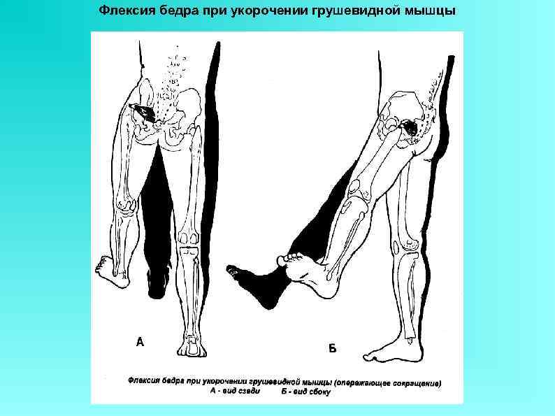 Грушевидная мышца отзывы форум. Грушевидная мышца. Укорочение грушевидной мышцы. Грушевидная мышца бедра. Мышцы бедра грушевидная мышца.