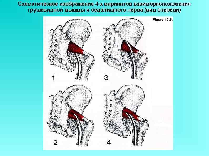 Средняя ягодичная мышца фото