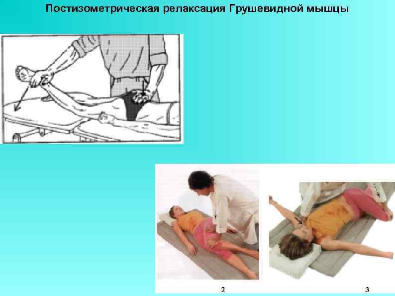 Постизометрическая релаксация Грушевидной мышцы 