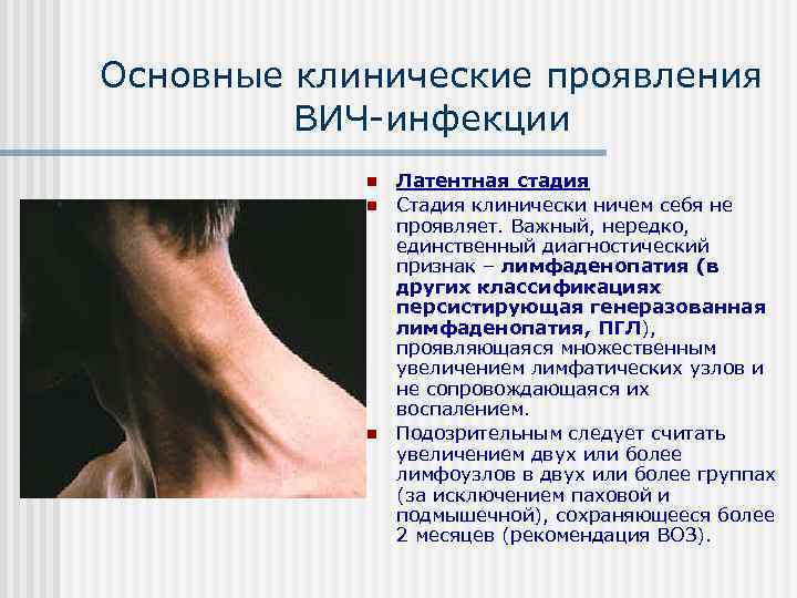 Основные клинические проявления   ВИЧ инфекции   n  Латентная стадия 