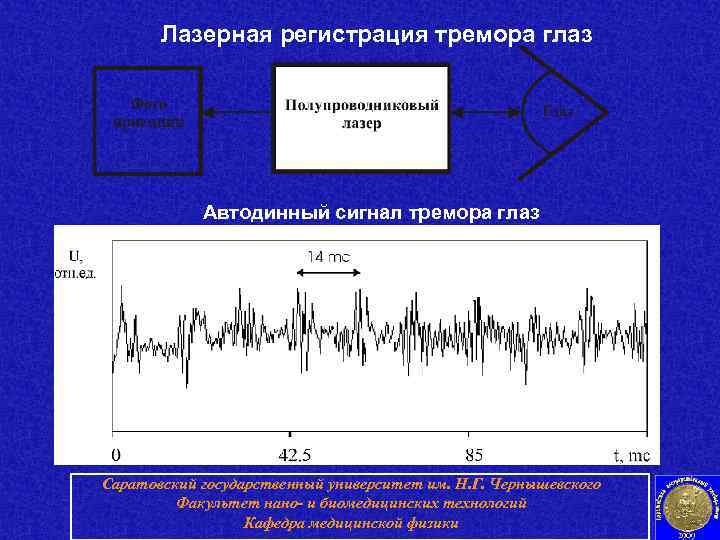   Лазерная регистрация тремора глаз   Автодинный сигнал тремора глаз Саратовский государственный