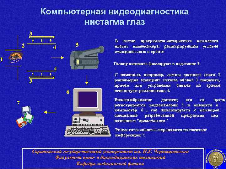   Компьютерная видеодиагностика  нистагма глаз       В