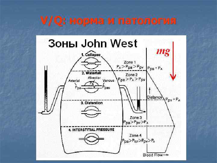 V/Q: норма и патология V/Q: норма и патология