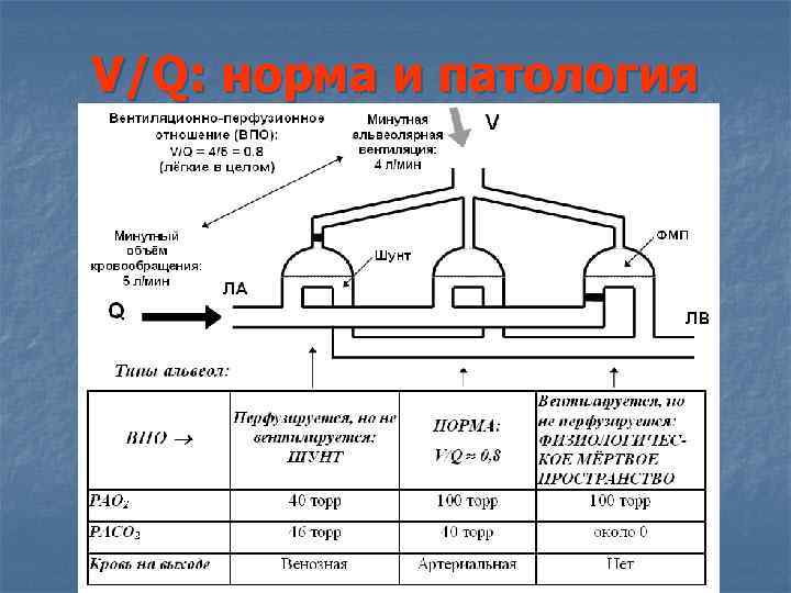 V/Q: норма и патология V/Q: норма и патология