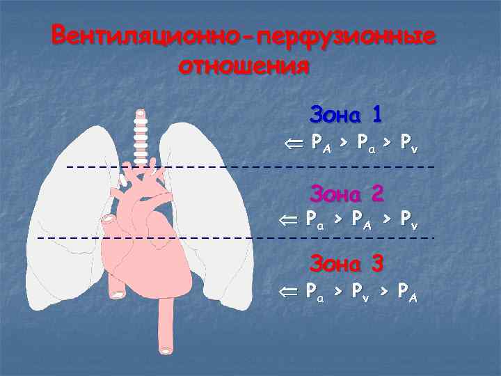 Вентиляционно-перфузионные   отношения    Зона 1   PA > P