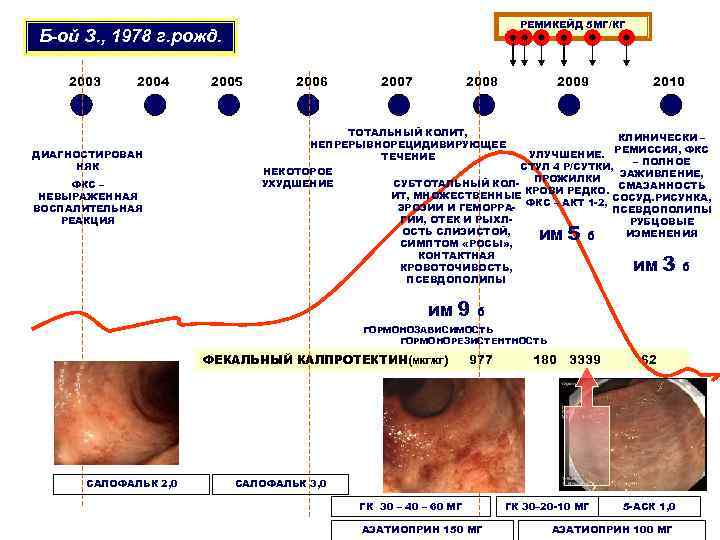       РЕМИКЕЙД 5 МГ/КГ Б-ой З. , 1978 г.