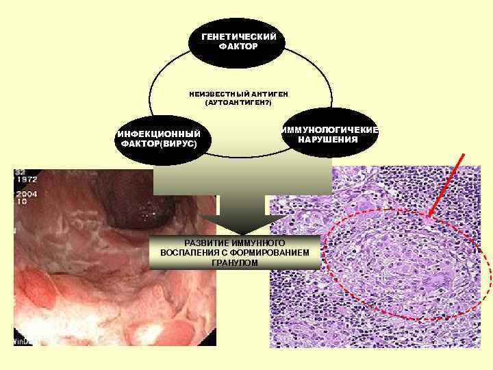    ГЕНЕТИЧЕСКИЙ     ФАКТОР    НЕИЗВЕСТНЫЙ АНТИГЕН
