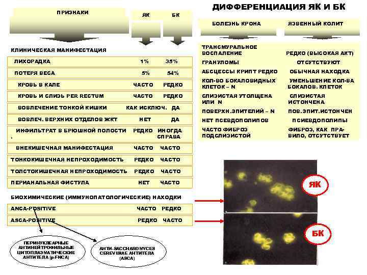       ДИФФЕРЕНЦИАЦИЯ ЯК И БК    ПРИЗНАКИ