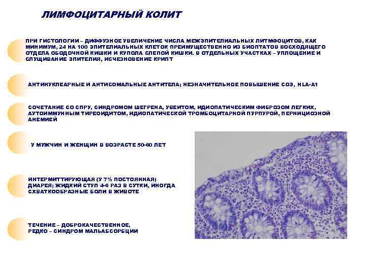   ЛИМФОЦИТАРНЫЙ КОЛИТ ПРИ ГИСТОЛОГИИ – ДИФФУЗНОЕ УВЕЛИЧЕНИЕ ЧИСЛА МЕЖЭПИТЕЛИАЛЬНЫХ ЛИТМФОЦИТОВ, КАК МИНИМУМ,