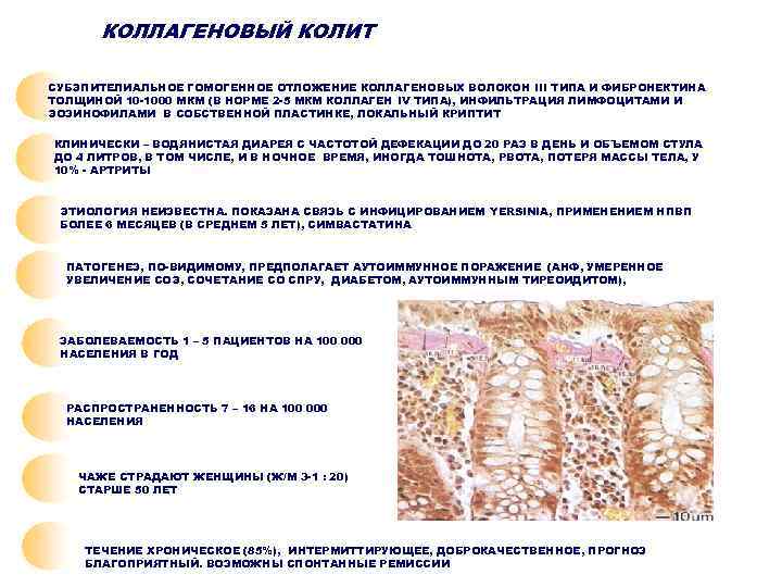  КОЛЛАГЕНОВЫЙ КОЛИТ СУБЭПИТЕЛИАЛЬНОЕ ГОМОГЕННОЕ ОТЛОЖЕНИЕ КОЛЛАГЕНОВЫХ ВОЛОКОН III ТИПА И ФИБРОНЕКТИНА ТОЛЩИНОЙ 10
