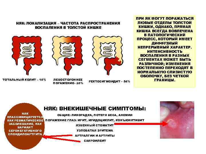       ПРИ ЯК МОГУТ ПОРАЖАТЬСЯ  НЯК: ЛОКАЛИЗАЦИЯ –