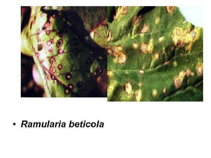  • Ramularia beticola 