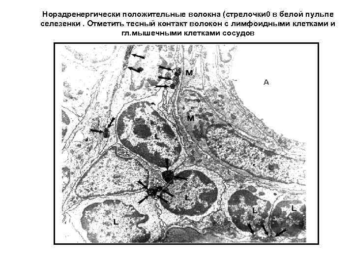 Норадренергически положительные волокна (стрелочки 0 в белой пульпе селезенки. Отметить тесный контакт волокон с