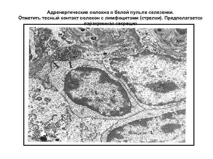   Адренергические волокна в белой пульпе селезенки. Отметить тесный контакт волокон с лимфоцитами