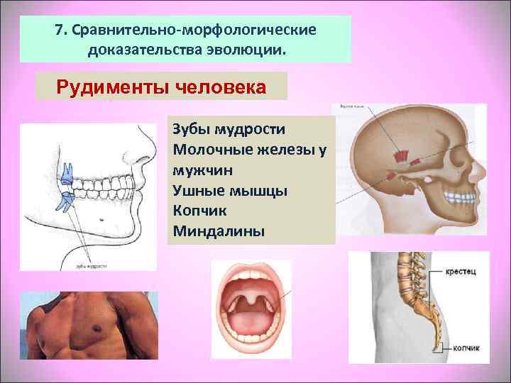 7. Сравнительно-морфологические доказательства эволюции.  Рудименты человека    Зубы мудрости  