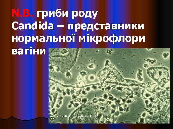 N. B. гриби роду Candida – представники нормальної мікрофлори вагіни  mit freundlicher Genehmigung