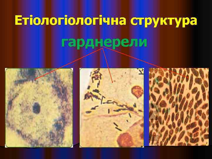 Етіологічна структура  гарднерели 