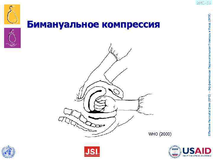       Бимануальное компрессия WHO (2000)    