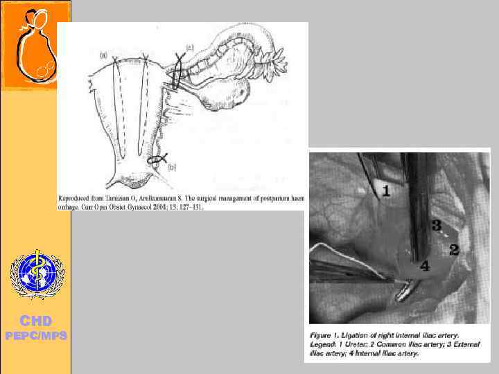 Child and Adolescent Health and Development   CHD  PEPC/MPS 