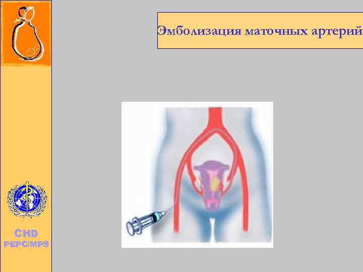 Child and Adolescent Health and Development   CHD  PEPC/MPS   