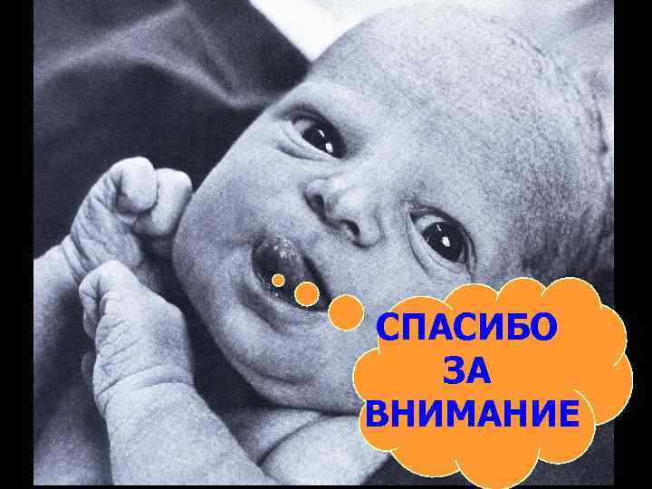 СПАСИБО  ЗА ВНИМАНИЕ 