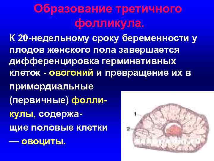   Образование третичного  фолликула. К 20 -недельному сроку беременности у плодов женского