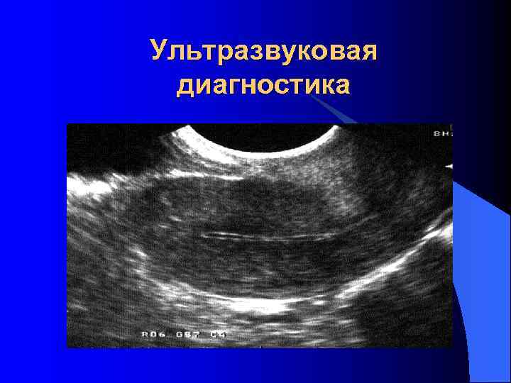 Ультразвуковая  диагностика 
