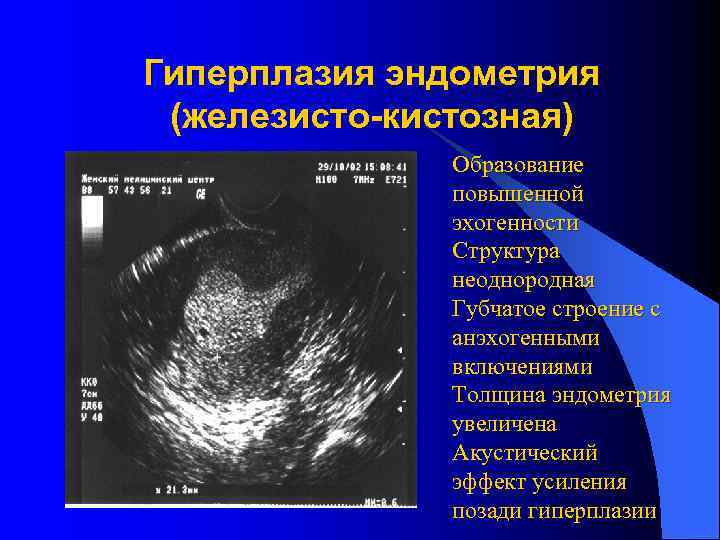 Гиперплазия матки в менопаузе чем опасно. Атипическая гиперплазия эндометрия УЗИ. Гиперплазия эндометрия на УЗИ. Гиперплазия железисто кистозная эндометрит. Кистозная гиперплазия эндометрия на УЗИ.