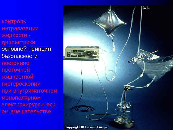 контроль интравазации жидкости - диэлектрика основной принцип безопасности постоянно- проточной жидкостной гистероскопии при внутриматочном