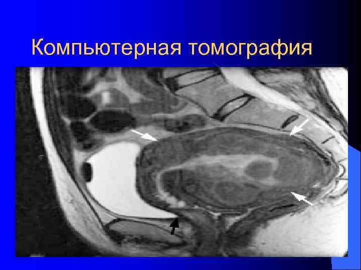 Компьютерная томография 