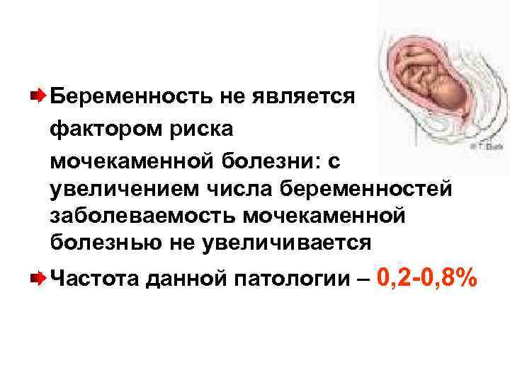 Беременность не является фактором риска мочекаменной болезни: с увеличением числа беременностей заболеваемость мочекаменной болезнью