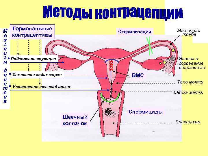   Гормональные       Маточная М   