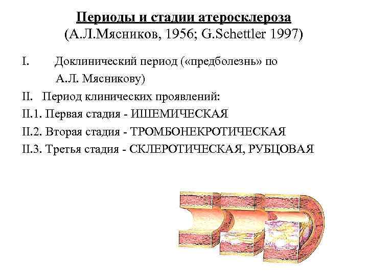    Периоды и стадии атеросклероза   (А. Л. Мясников, 1956; G.