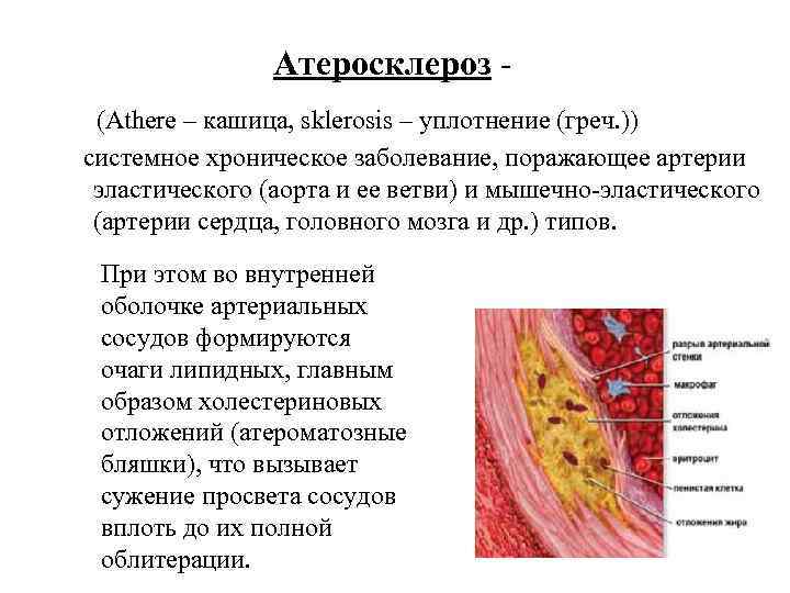    Атеросклероз - (Athere – кашица, sklerosis – уплотнение (греч. )) 