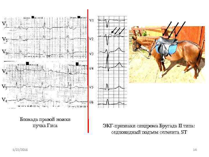 V 1 V 2 V 3  V 4 V 5 V 6 