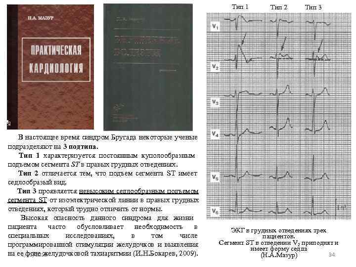        Тип 1  Тип 2 Тип 3