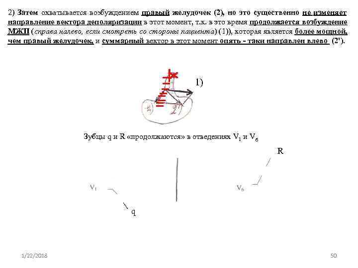 2) Затем охватывается возбуждением правый желудочек (2), но это существенно не изменяет направление вектора
