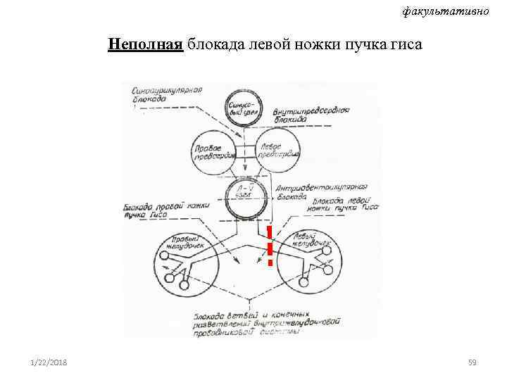     факультативно   Неполная блокада левой ножки пучка гиса 1/22/2018