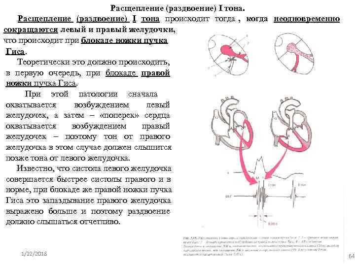      Расщепление (раздвоение) I тона происходит тогда , когда неодновременно
