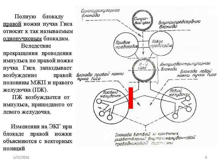  Полную блокаду правой ножки пучка Гиса относят к так называемым однопучковым блокадам. 