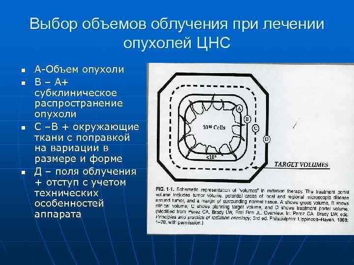   Выбор объемов облучения при лечении    опухолей ЦНС n 