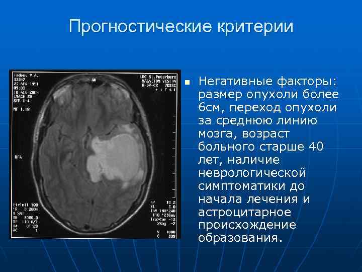 Прогностические критерии   n  Негативные факторы:   размер опухоли более 