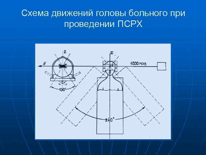 Схема движений головы больного при   проведении ПСРХ 