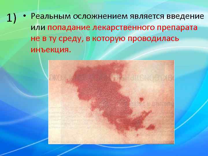 1)  • Реальным осложнением является введение   или попадание лекарственного препарата 