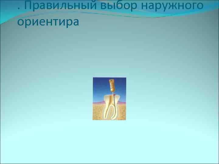 . Правильный выбор наружного ориентира 