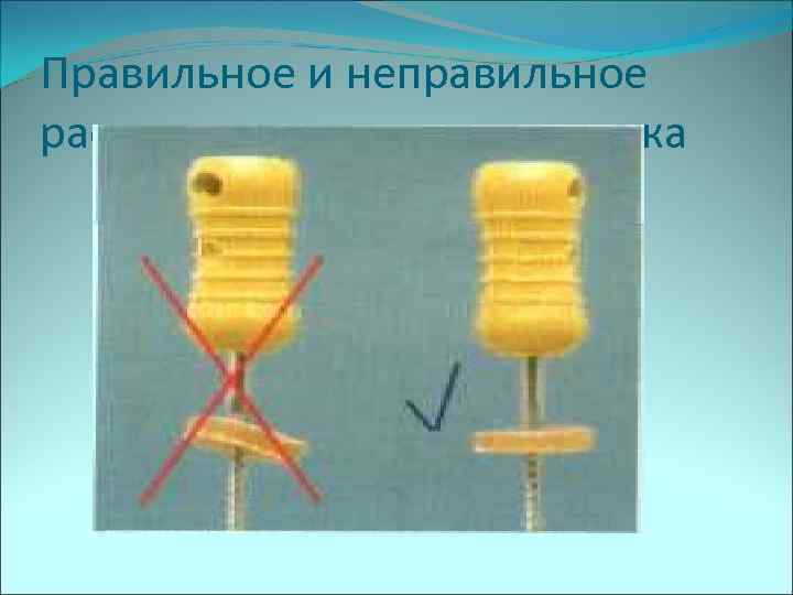 Правильное и неправильное расположение стоп отметчика 