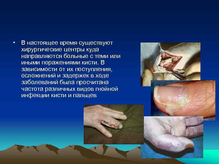  • В настоящее время существуют  хирургические центры куда  направляются больные с